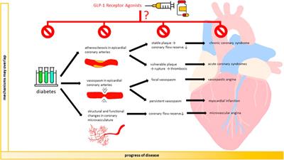 GLP-1 Receptor Agonists and Coronary Arteries: From Mechanisms to Events